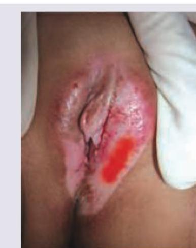 Image for question 94