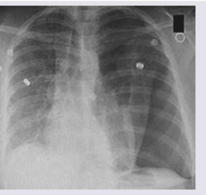 Image for question 7