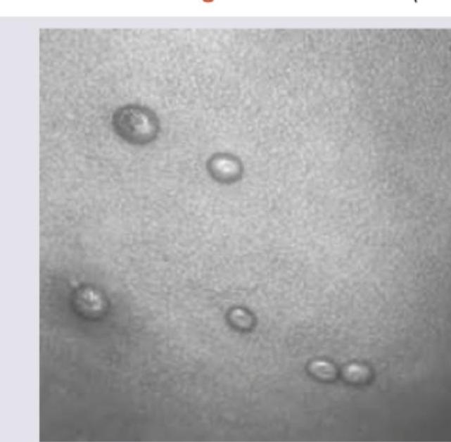 Image for question 166