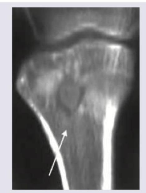 Image for question 192