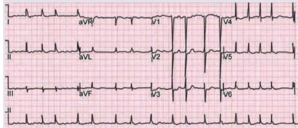 Image for question 1