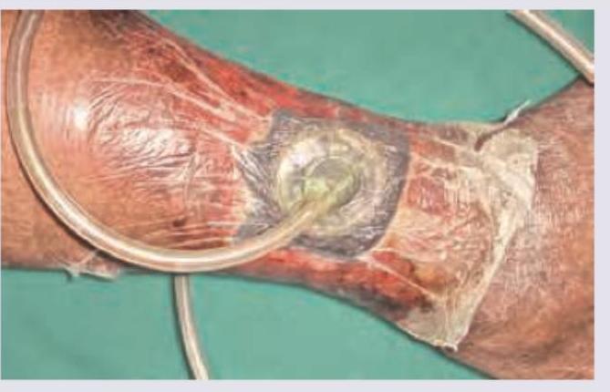 Image for question 789