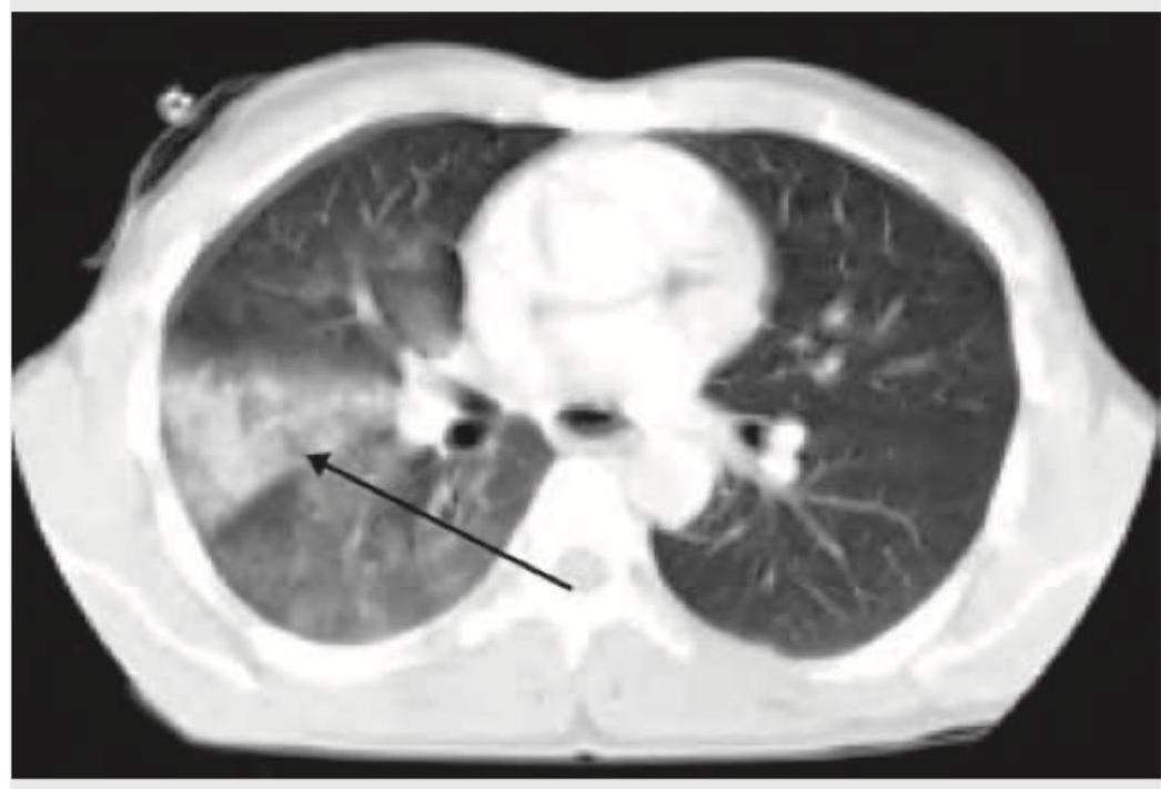 Image for question 11