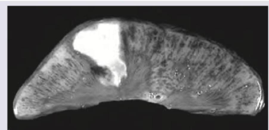 Image for question 170