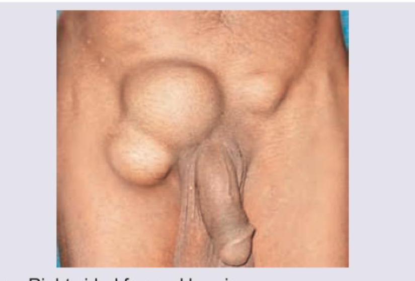 Image for question 777