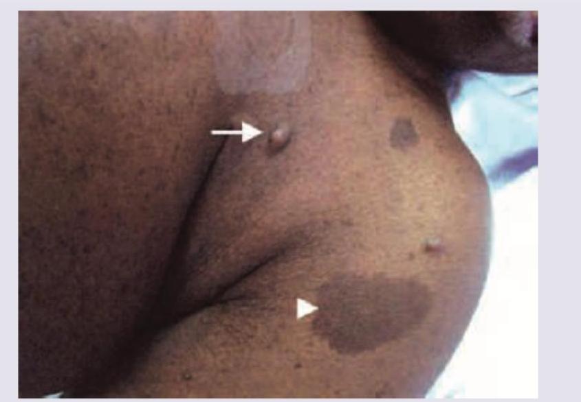 Image for question 216