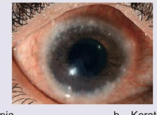 Image for question 325