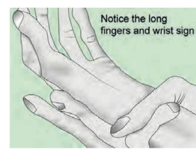 Image for question 1312