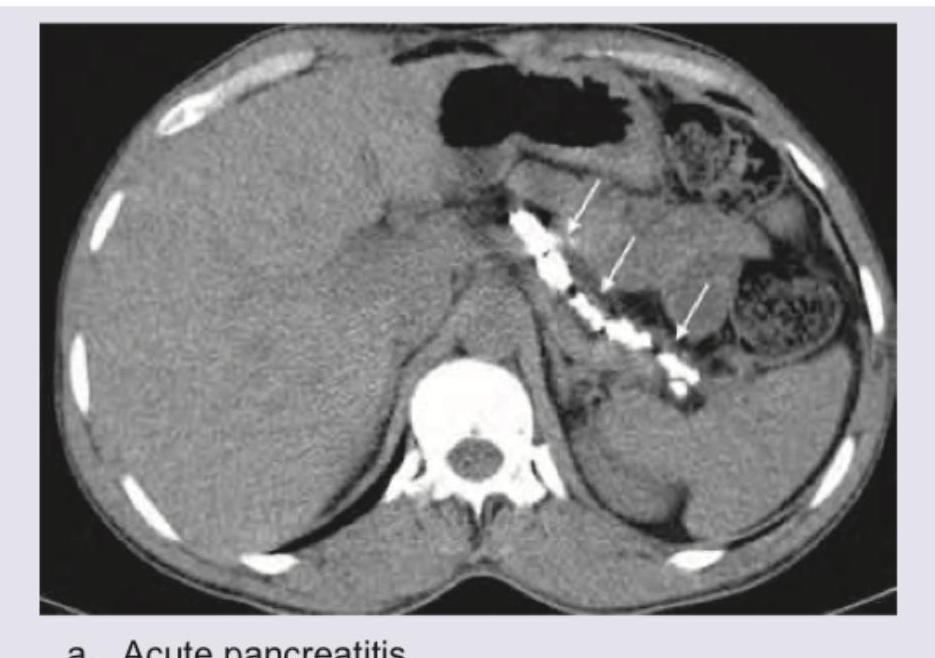 Image for question 366