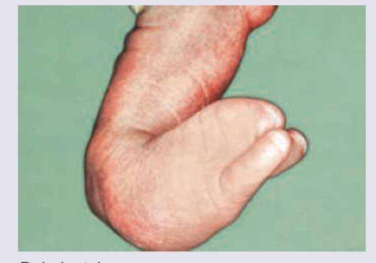 Image for question 651