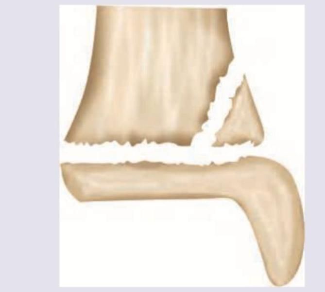 Image for question 276