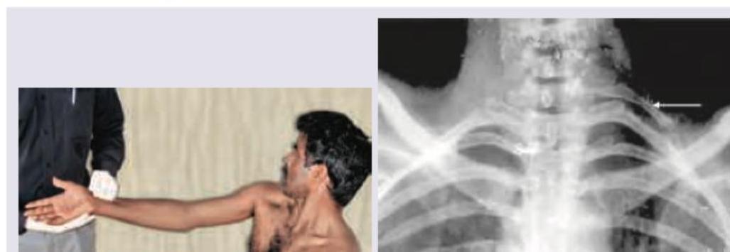 Image for question 148