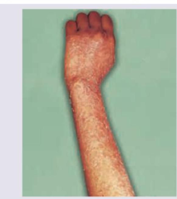 Image for question 113