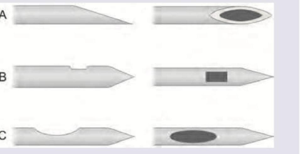 Image for question 309