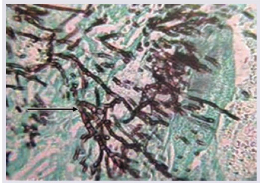 Image for question 5