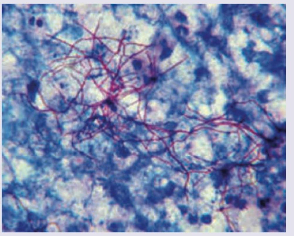 Image for question 9