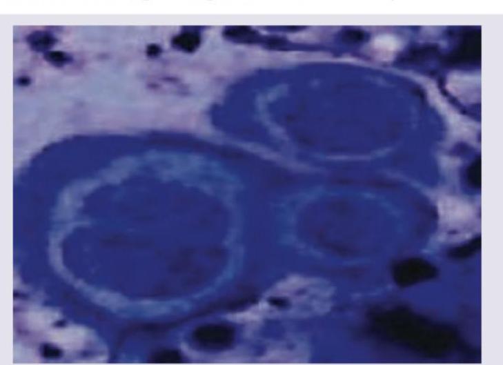 Image for question 178