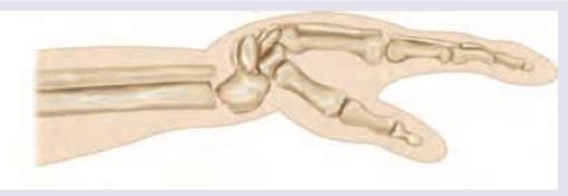 Image for question 918