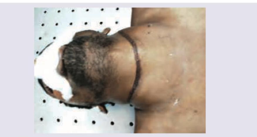 Image for question 215