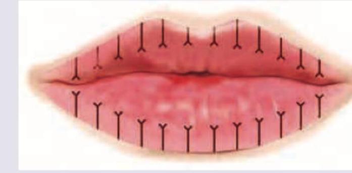 Image for question 302