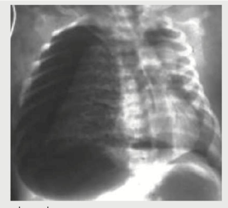 Image for question 69