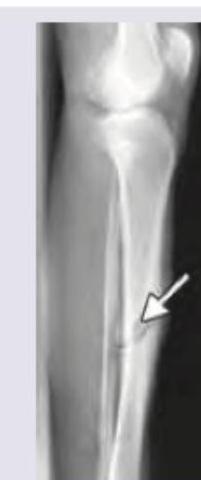 Image for question 904