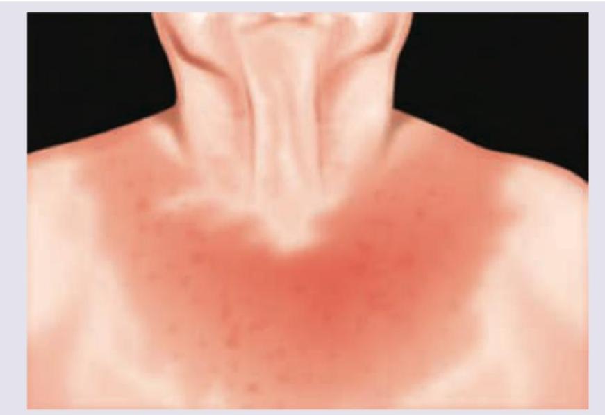 Image for question 617