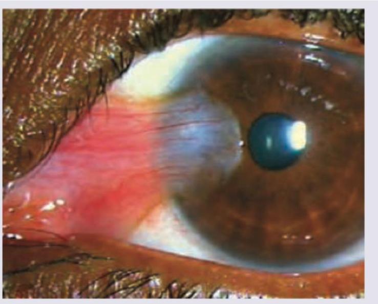 Image for question 336