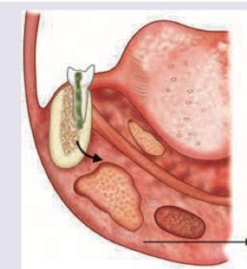 Image for question 305