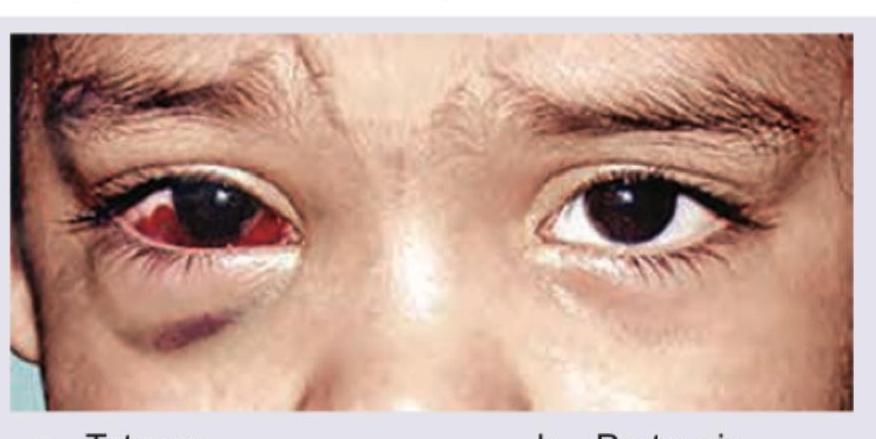 Image for question 353