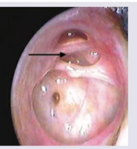 Image for question 208