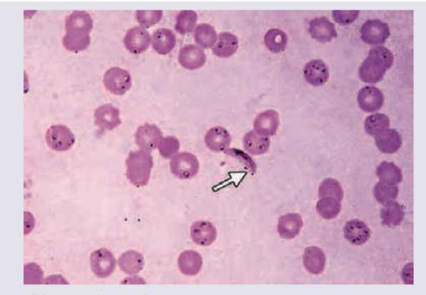 Image for question 173