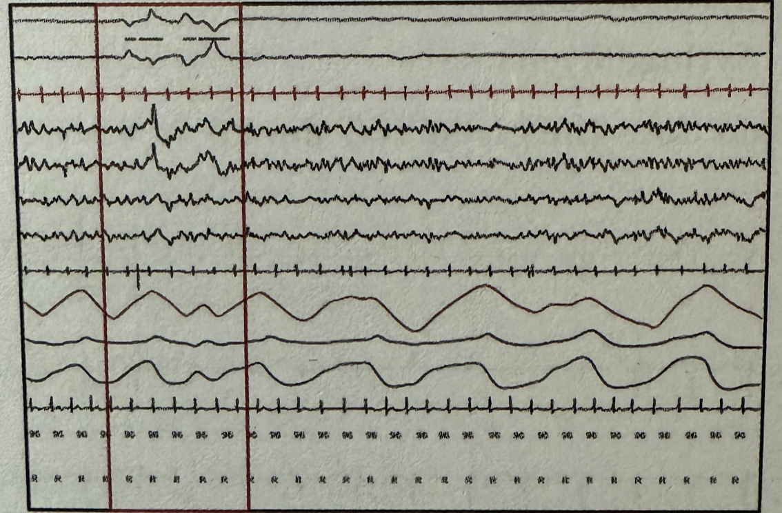 Image for question 3