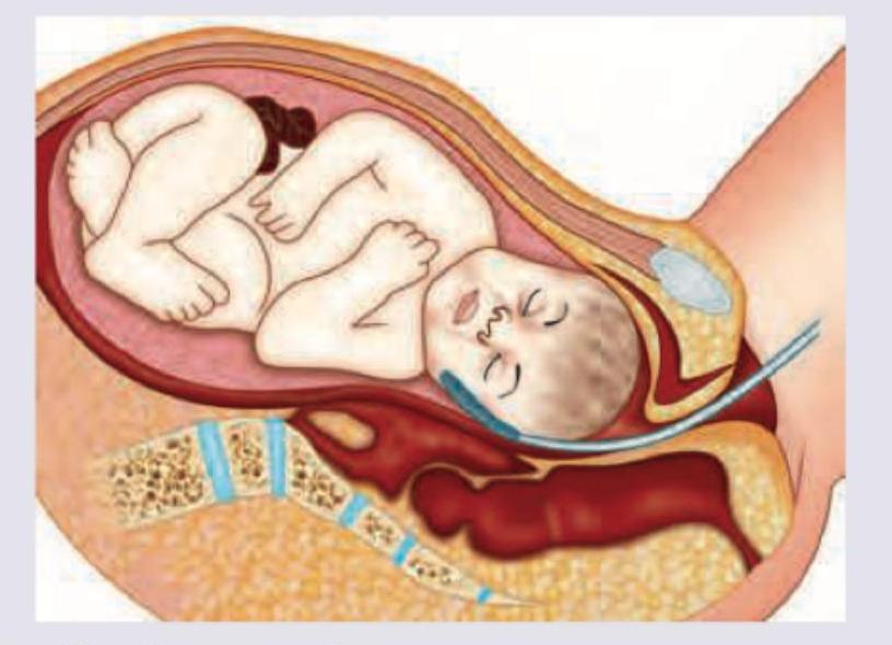 Image for question 830