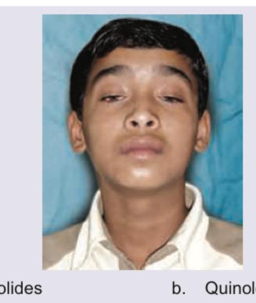 Image for question 1297