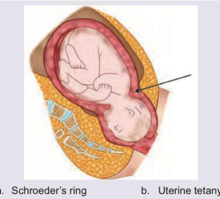 Image for question 833