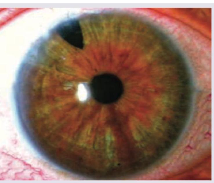 Image for question 244