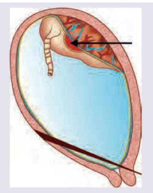 Image for question 933