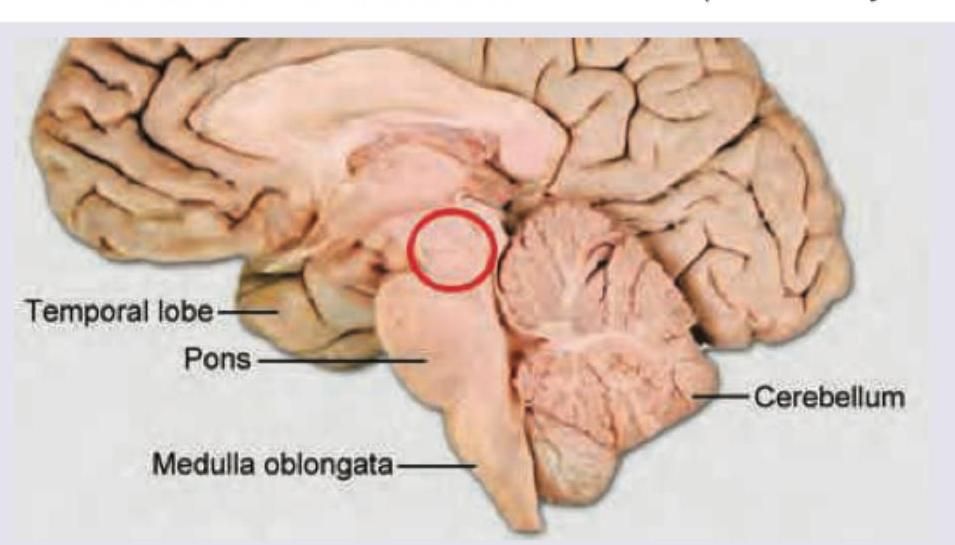 Image for question 51
