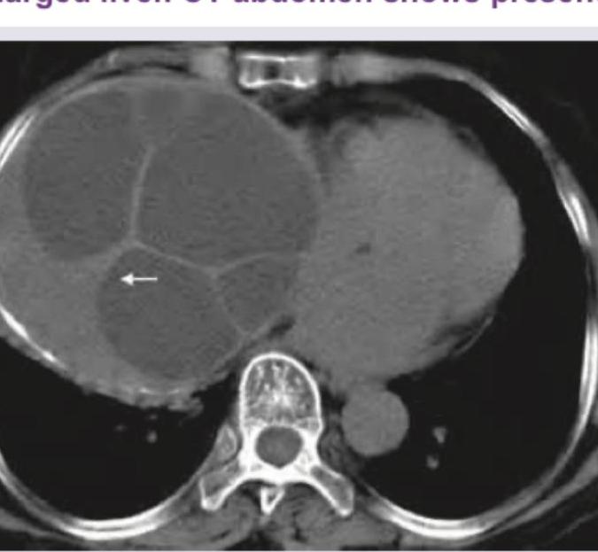 Image for question 738