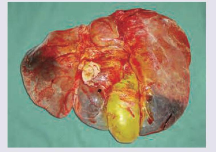 Image for question 127