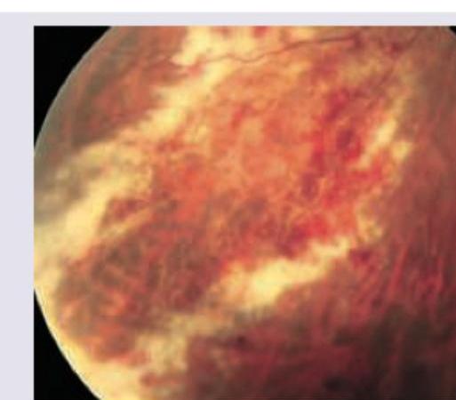 Image for question 1294