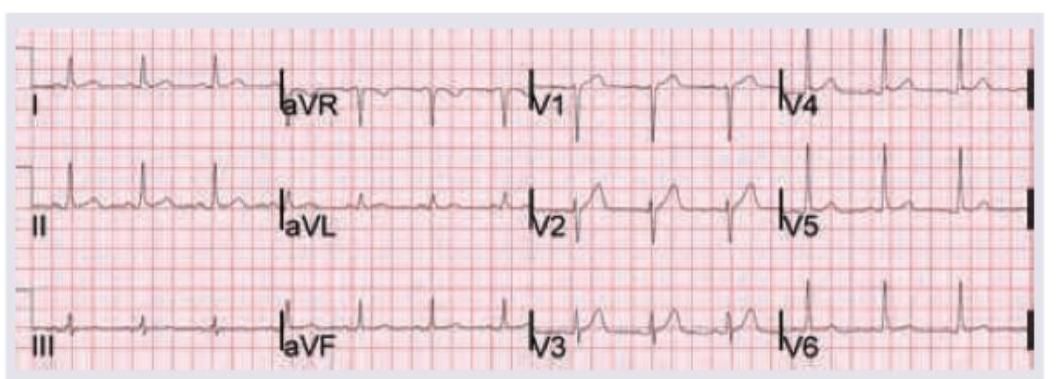 Image for question 1