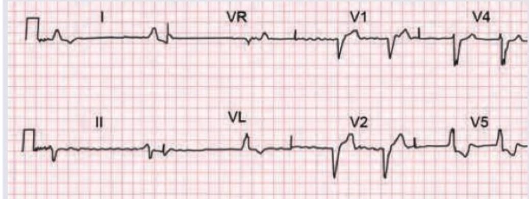 Image for question 109