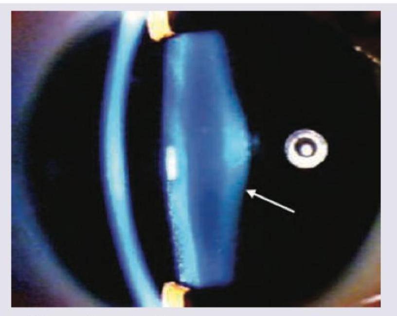 Image for question 555