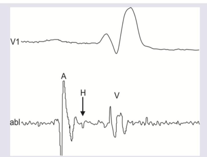 Image for question 728