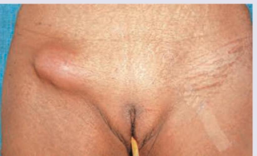 Image for question 778