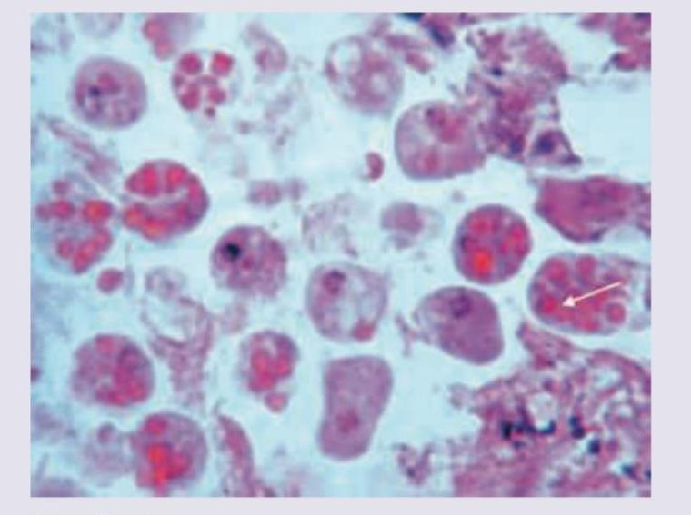 Image for question 110