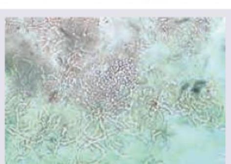 Image for question 115