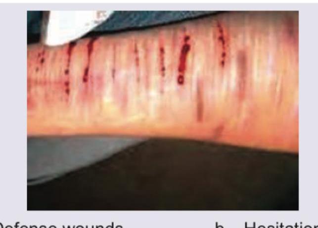 Image for question 116